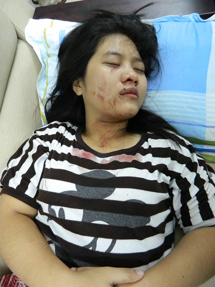 Nguyễn Thảo Chi bị đánh gẩy 3 chiếc răng